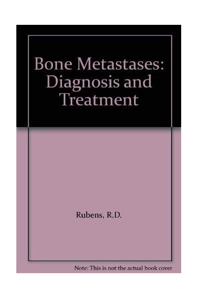 Bone Metastases: Diagnosis And Treatment